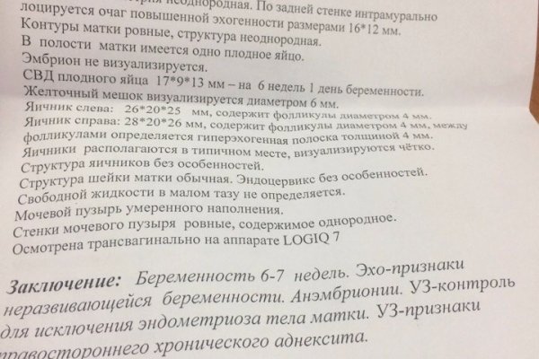 Кракен не заходит